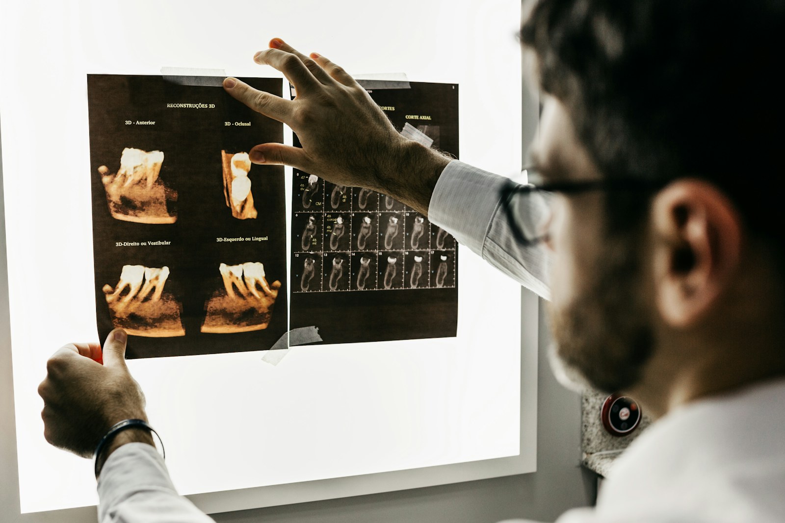Dental CT scans reviewed on a light box